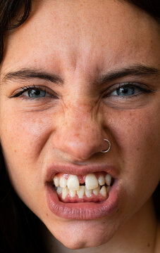 close up of an angry woman with diastema