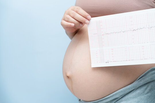 Close up Pregnant woman holding ctg graph in hand on blue background. Waiting baby concept.