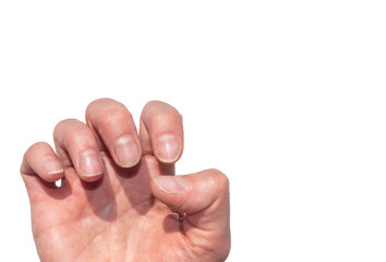 Close-up of weak broken natural nails, devoid of nutrients, no manicure isolated on white background