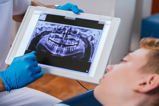 A dentist shows the patient an X-ray image of his teeth on the screen.