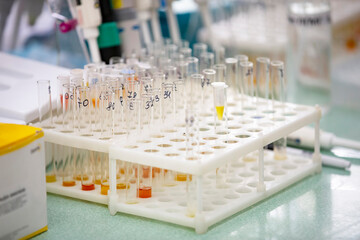 Many glass test tubes with analyzes in a medical laboratory.