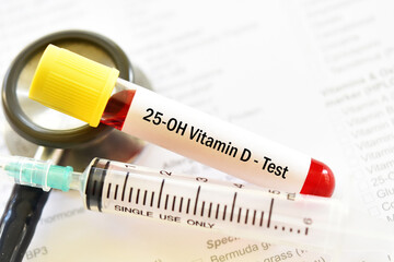 Test tube with blood sample for 25-OH vitamin D or vitamin D2/D3 test, diagnosis for bone disease