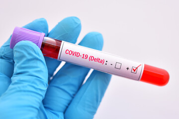 Delta variant COVID-19 positive, blood sample tube positive with delta variant or Indian strain...