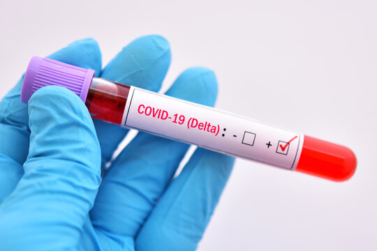 Delta variant COVID-19 positive, blood sample tube positive with delta variant or Indian strain COVID-19 
