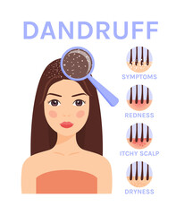 Dandruff and Magnifying Glass on the Head of pretty Woman.Disease and Treatment of the Scalp and Hair.Symptoms of dandruff.Flat color cartoon style. White background.Illustration for medical design. - obrazy, fototapety, plakaty