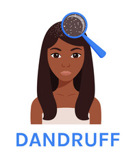 Pretty Afro Black Girl and Dandruff on her Head for medical design. Hair scalp problem. Close-up view of dandruff Magnifying Glass. Flat color cartoon style. White background. Vector illustration.