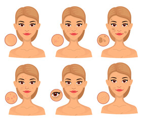 Seth woman different types of problem skin, enlarged area for cosmetology. Acne, wrinkles and age spots.