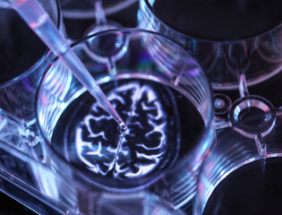 Medical sample inside microplate with image of human brain