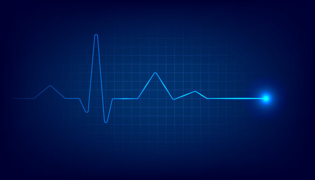 Blue heart pulse monitor with signal. Heart beat cardiogram background.