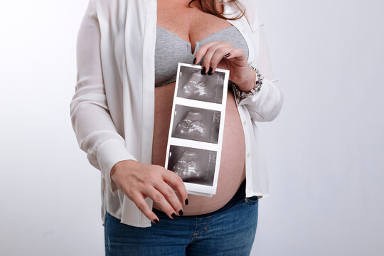 Unrecognizable pregnant woman holding ultrasound images of her unborn baby over the belly on white background
