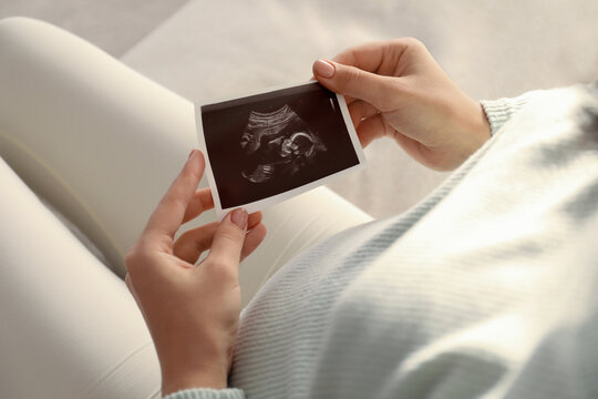 Pregnant young woman holding ultrasound picture near her belly at home, closeup
