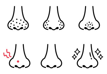 鼻の毛穴の汚れのイラスト　シンプル線画　Blackheads on the nose