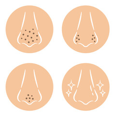 鼻の毛穴の汚れのイラスト　おしゃれタッチアイコン　nose Blackhead pores