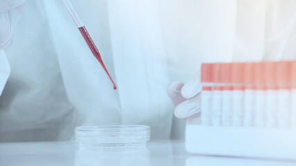 Close up laboratory worker hold blood sample in tube and place on rack.