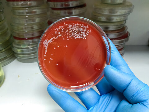 Bacterial culture on petri dish, urinary tract infection Streptococcus , Staphylococcus bacteria.