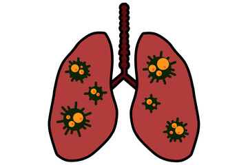 Virus cells in lung. Infected lungs. Coronavirus, COVID-19. 2019-nCoV. lung disease, pneumonia, asthma, cancer, tuberculosis.
