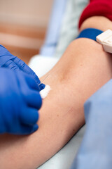 medical nurse with blue latex gloves inputs catheter to vein patient for drip of chemotherapy or another liquid medicine from cancer