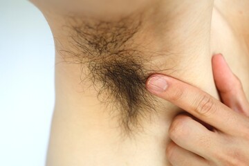男性の腋毛