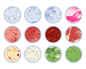 Petri dish, plate with agar, bacterial colony. Bacteriology. Microbiology. Laboratory test, bacteriological swab, chemical analysis. Vector flat cartoon illustration