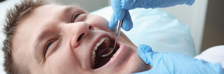 Dentist examining oral cavity of male patient with mirror