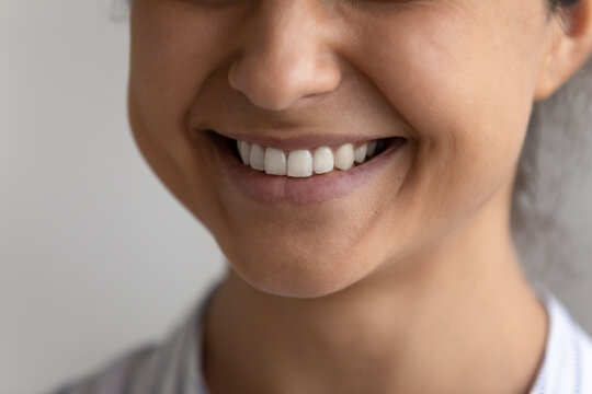 Crop close up of happy young Indian woman show healthy white event teeth after good quality dental treatment or service. Smiling mixed race female demonstrate tooth whitening. Dentistry concept.