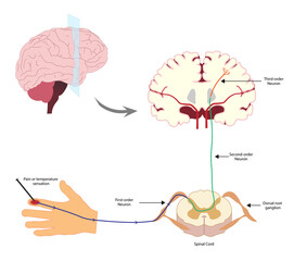 Pain Pathway. Nociception.  Ascending pathway that connect the periphery with the brain during pain and temperature sensation. Hand, spinal cord and brain. 
