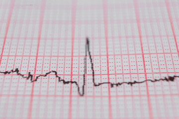 Heart electrocardiogram EKG chart on special paper. Concept for heart scan, health insurance, medical background, examination.