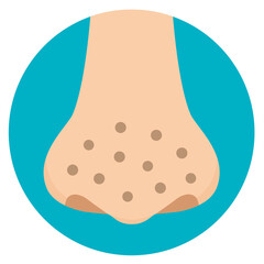 鼻の毛穴の汚れイラスト　いちご鼻　フラットデザイン