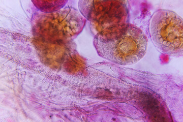 daphnia microscopic photo background