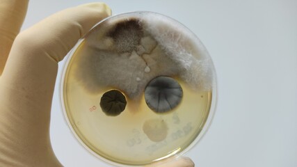 Quality control microorganism test mold culture result