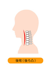 頸椎後湾症の首の骨のイメージ