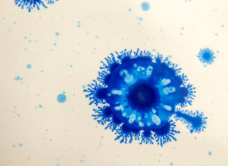 A blue drop of paint on a yellow background, similar to coronavirus molecules. Close-up