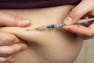 Injection of insulin into abdomen, stomach of pregnant women from syringe, diabetes