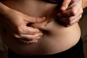 Obraz na płótnie Canvas Injection of insulin into abdomen, stomach of pregnant women from syringe, diabetes
