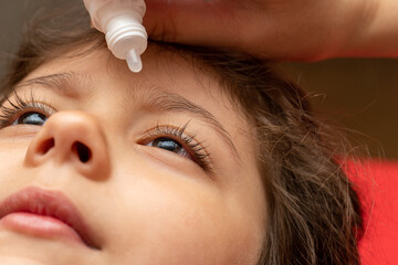 treatment, using therapeutic, medical eye drops for a child with conjunctivitis