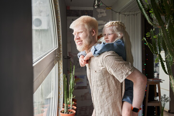 Girl embracing with her albino father and looking at the window with interest - Powered by Adobe
