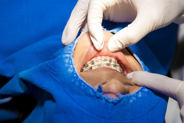 Orthodontics in dental clinic