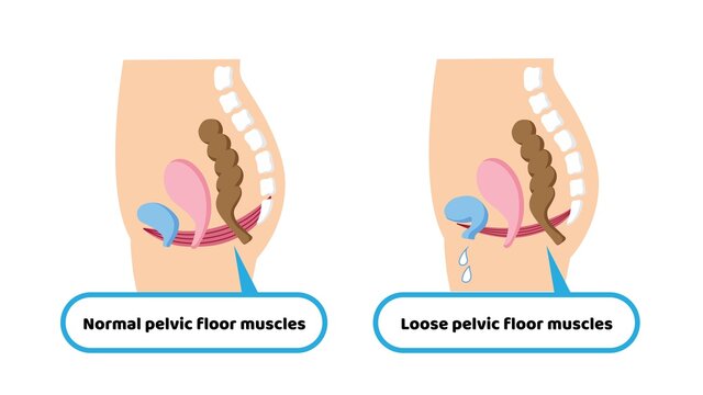 Medical Illustration Of Pelvic Floor Muscles