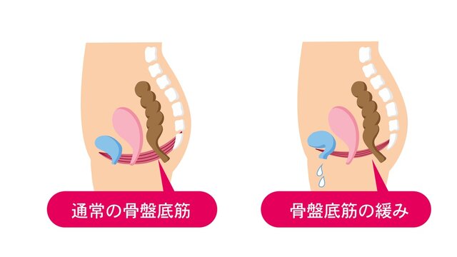 105 Best 尿失禁 Images Stock Photos Vectors Adobe Stock 105 Best 尿失禁 Images Stock Photos Vectors Adobe Stock