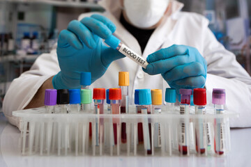 Laboratory Technician Using Tube Rack With Patient Blood Samples. Doctor analyzing blood samples in analysis laboratory