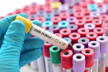 Fototapeta premium Beta variant COVID-19 positive, blood sample tube positive with Beta variant or South Africa strain COVID-19