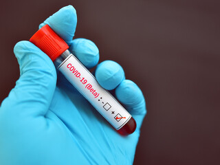 Obraz premium Beta variant COVID-19 positive, blood sample tube positive with Beta variant or South Africa strain COVID-19