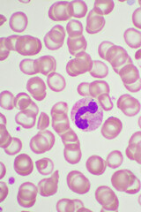 Segmented neutrophil cell in human blood smear, analyze by microscope, original magnification 1000x