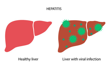 Liver disease concept