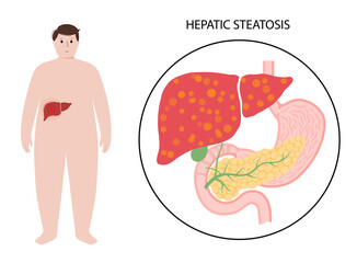 Liver disease concept