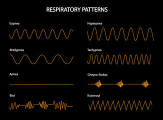 Respiratoy Patterns. Respiratory curves of different situations. Eupnea, hyperpnea, Bradypnea, Tachypnea, Apnea, Cheyne-Strokes, Biot, Kussmaul.   