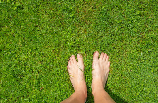 Woman Sitting Barefoot On A Lush Green Lawn. Smooth Sexy Female Legs Outdoors Walking In The Park. Varicose Veins Medicine Concept.