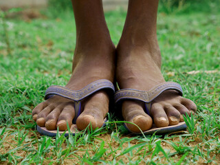 Poor boy feet with sleeper closeup