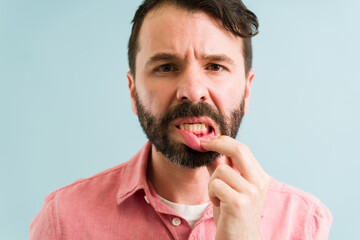 Young man suffering from gingivitis