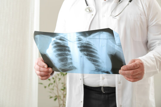 Senior doctor with x-ray image of lungs in clinic